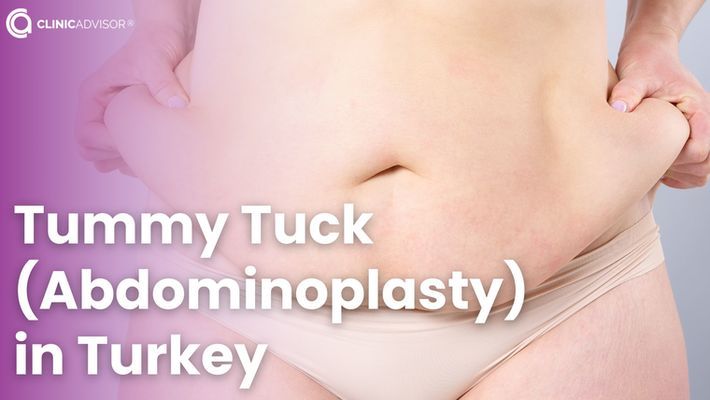 Tummy Tuck (Abdominoplasty) in Turkey with Expert Surgeons
