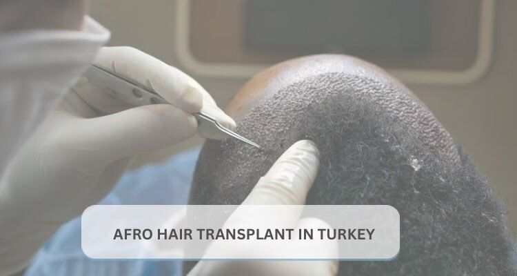 Afro Hair Transplant in Turkey (2026–2027 Guide): Candidacy, Techniques, Costs, Safety & Results