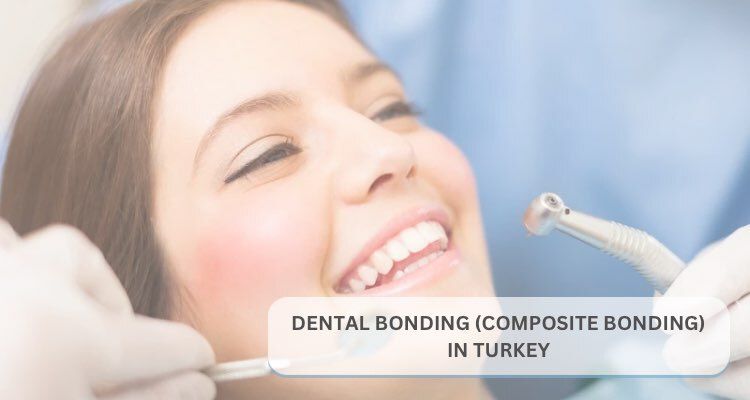 Dental Bonding (Composite Bonding) in Turkey | Complete 2025–2026 Guide