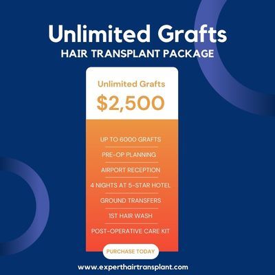 Unlimited Grafts Hair Transplant Package in Turkey
