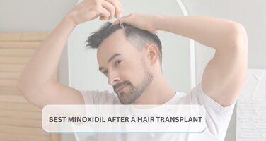 3 Best Minoxidil After Hair Transplant (2026)