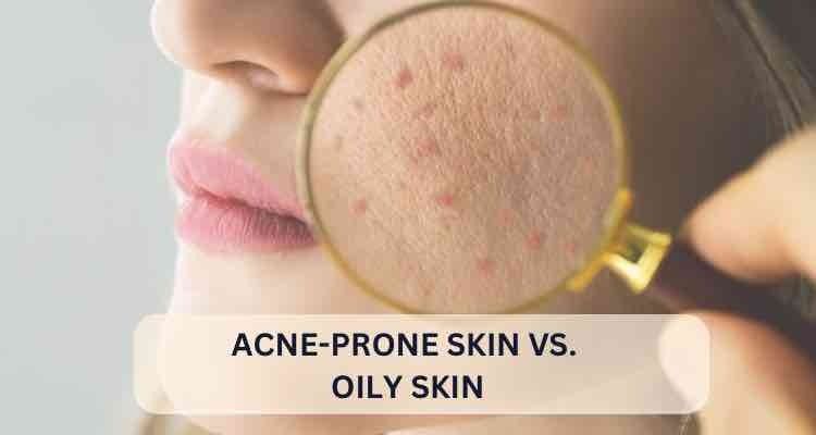 Acne-Prone Skin vs. Oily Skin