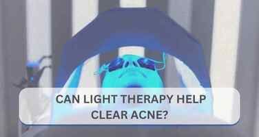 Can LED Light Therapy Really Help Clear Acne?