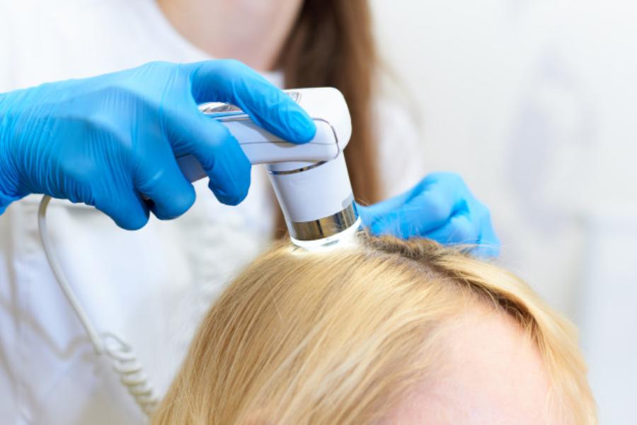 Hair Loss Consultation: is it time to see a doctor?