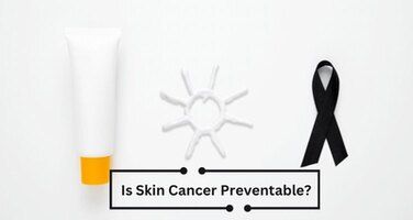 Is Skin Cancer Preventable? How to Lower Your Skin Cancer Risk Factors