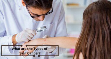 Skin Cancer Types