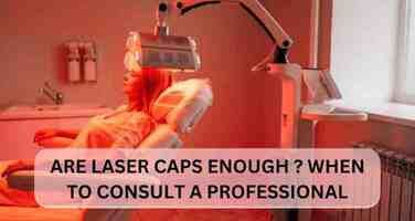 When to Consult a Professional: Knowing When Laser Caps Alone Aren’t Enough for Hair Regrowth